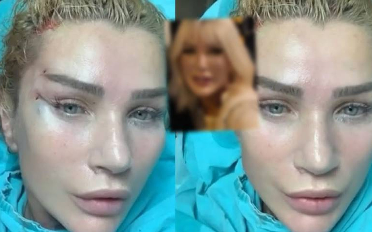 Seda Sayan Estetik Operasyonu Sonrasi Ilk Kez Fotograf Paylasti F5haber