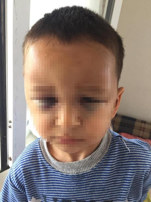 Muğla'da 3 yaşındaki çocuğa kan donduran şiddet - Resim : 1
