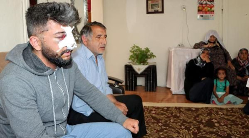 Yan bakma kavgasında yaralanan Ömer'in annesi konuştu - Resim : 1