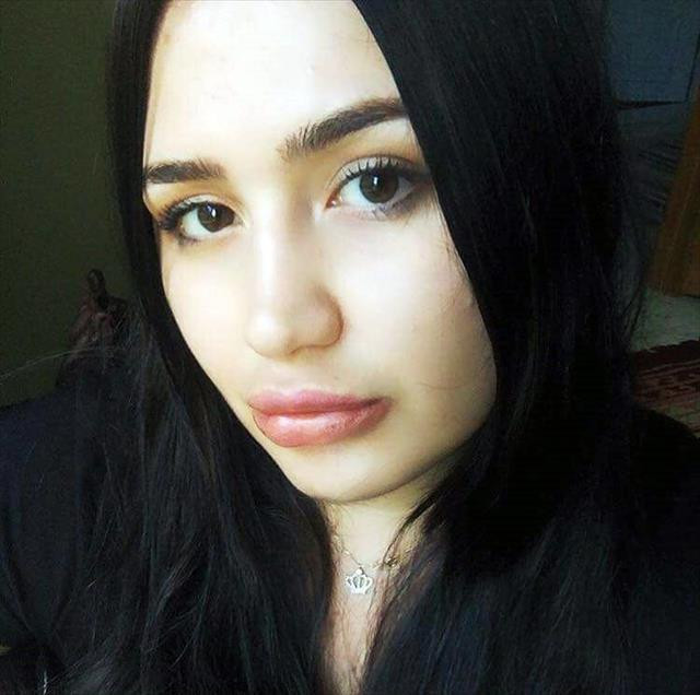 Silikon mağduru hemşirenin son hali F5Haber